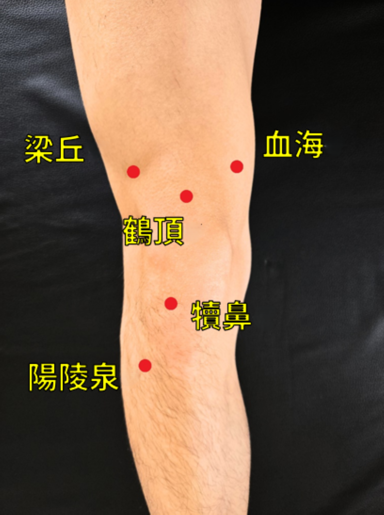 退化性膝關節炎